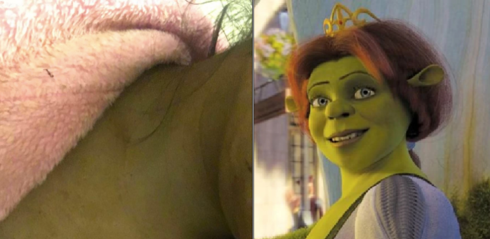 ¡Se puso verde!: probó bronceador barato y terminó como Fiona (FOTOS)