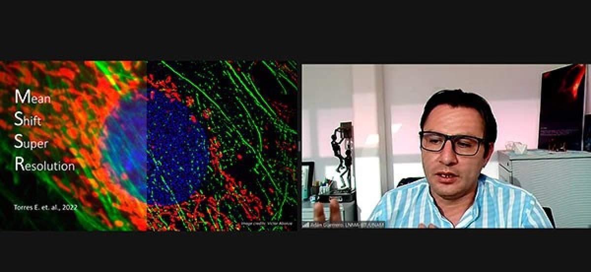 Crean en la UNAM algoritmo que mejora imágenes fluorescentes con superresolución