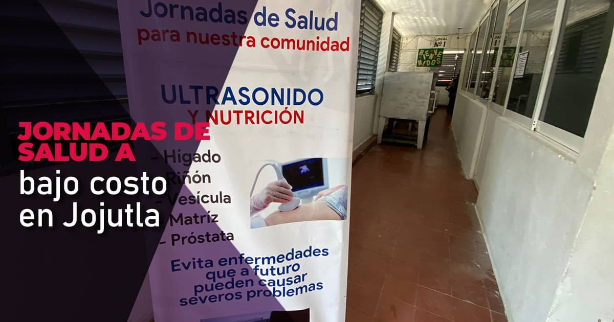 Comienzan jornadas de salud a bajo costo en Jojutla