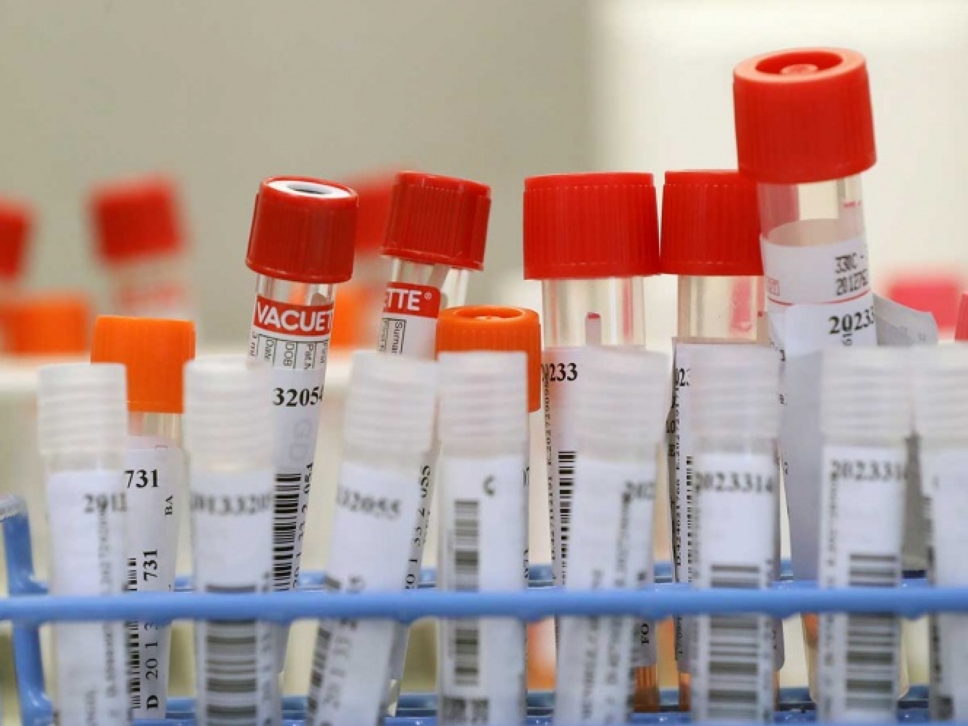 Roche y Regeneron desarrollan juntos coctel contra Covid-19