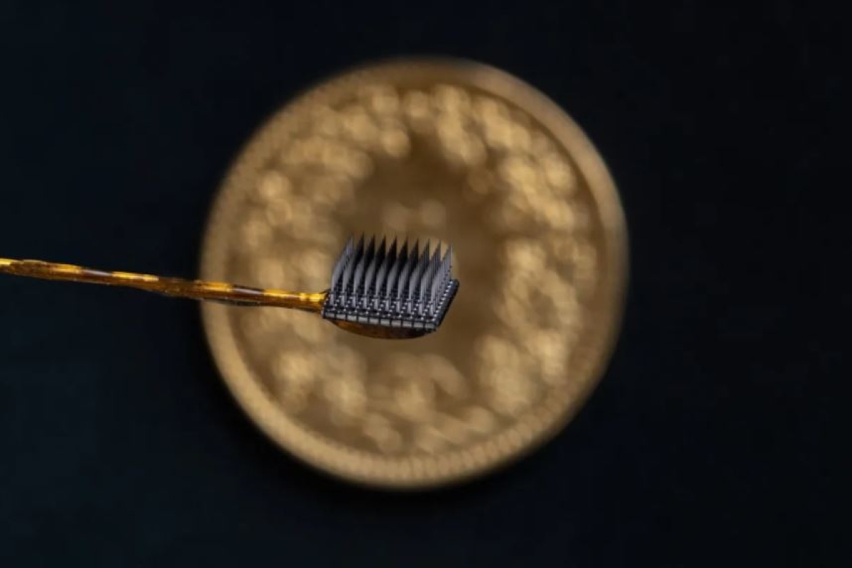 Implantan chips a paciente con parálisis, pudo volver a comunicarse con palabras