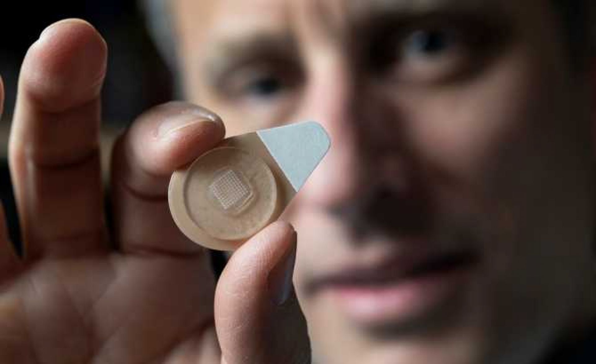 El parche de microagujas: el nuevo anticonceptivo de acción prolongada