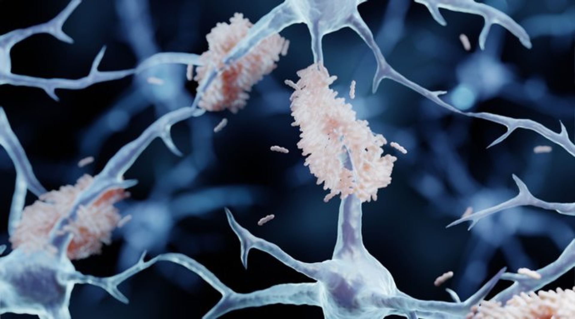 La calidad del sueño influye en el desarrollo del Alzheimer