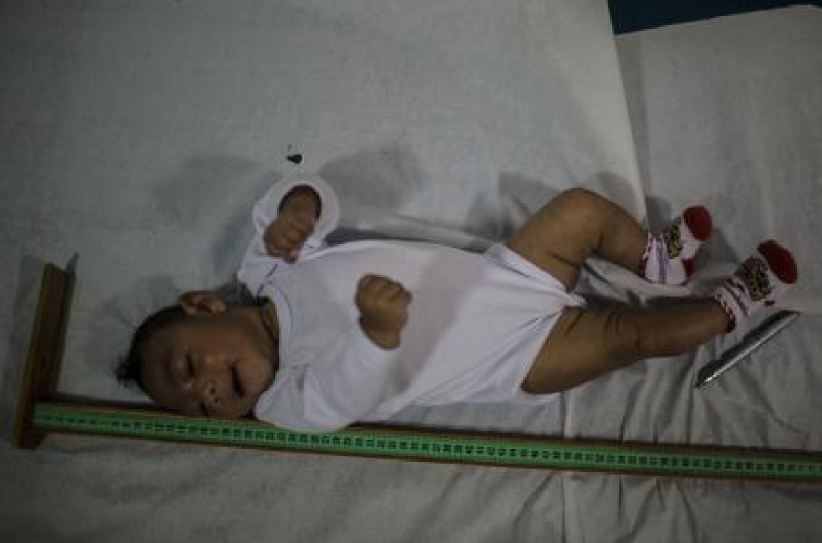 Los médicos se preparan para los bebés con zika