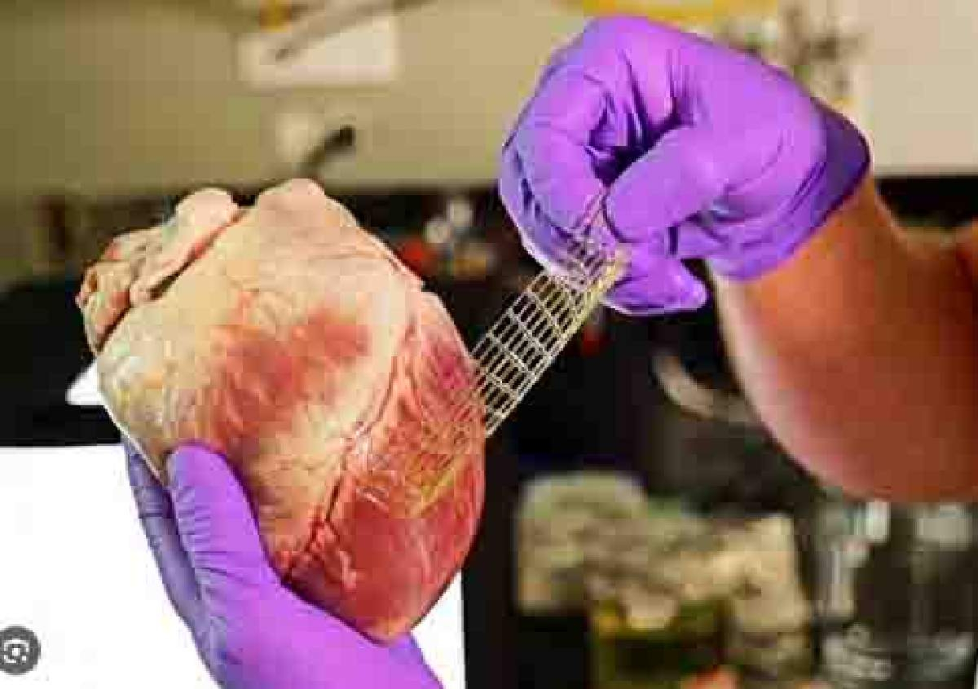 ¿Una curita para el corazón? Un nuevo método de impresión 3D hace posible esto y mucho más