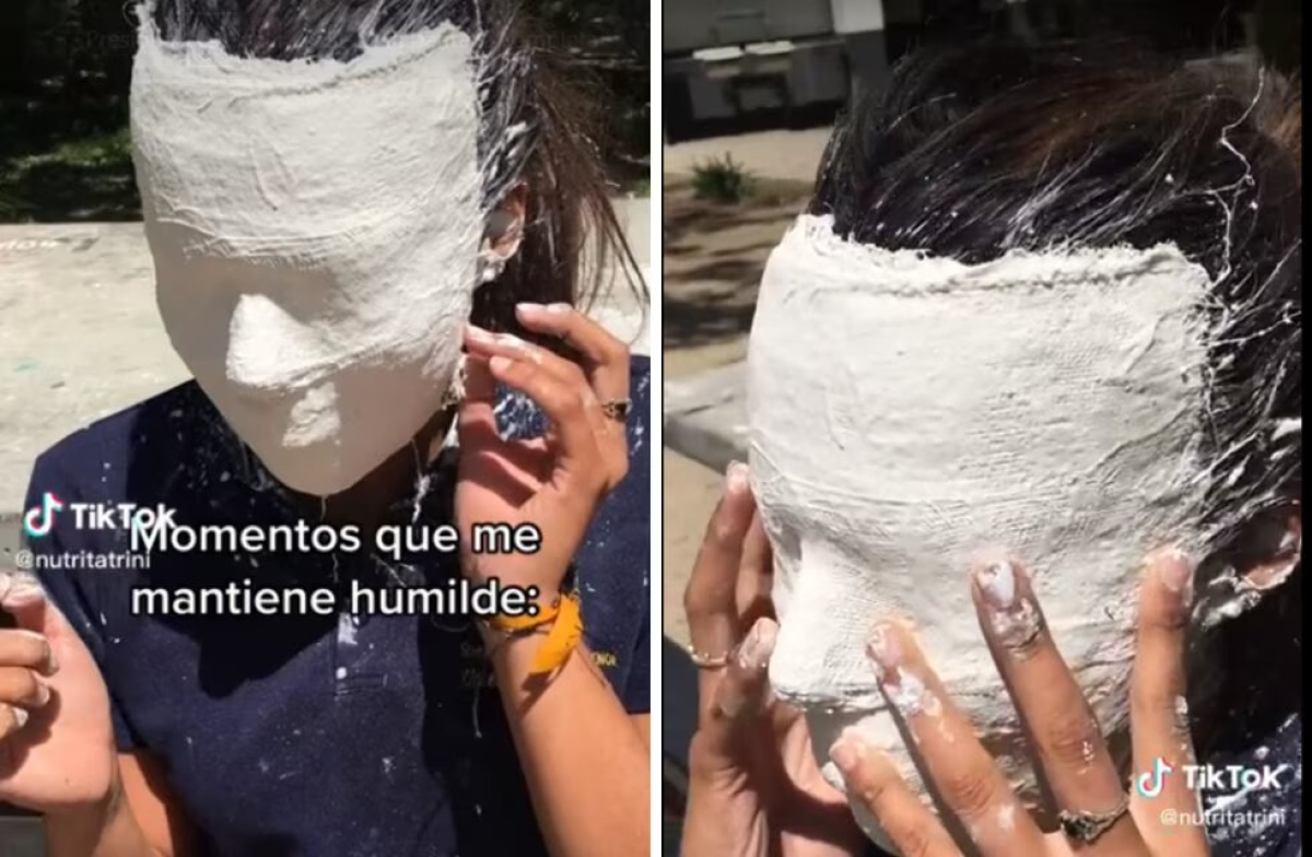 Joven se pone máscara de yeso y no puede quitársela