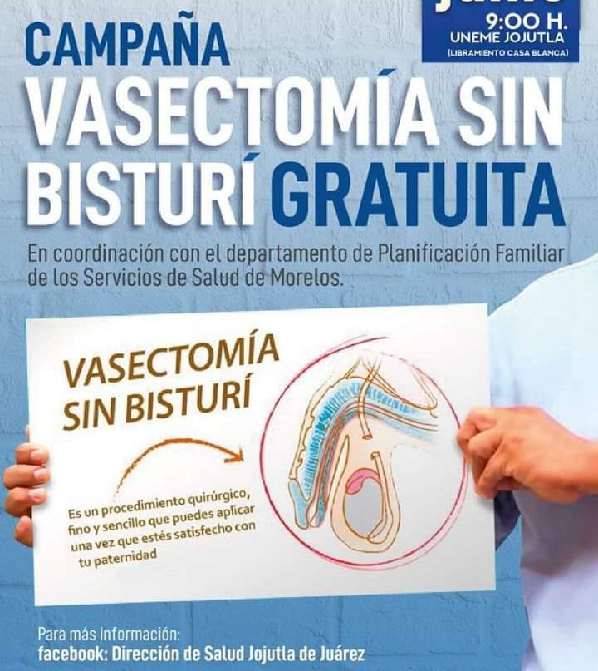 Jojutla será sede de la “megacampaña” de vasectomía gratuita