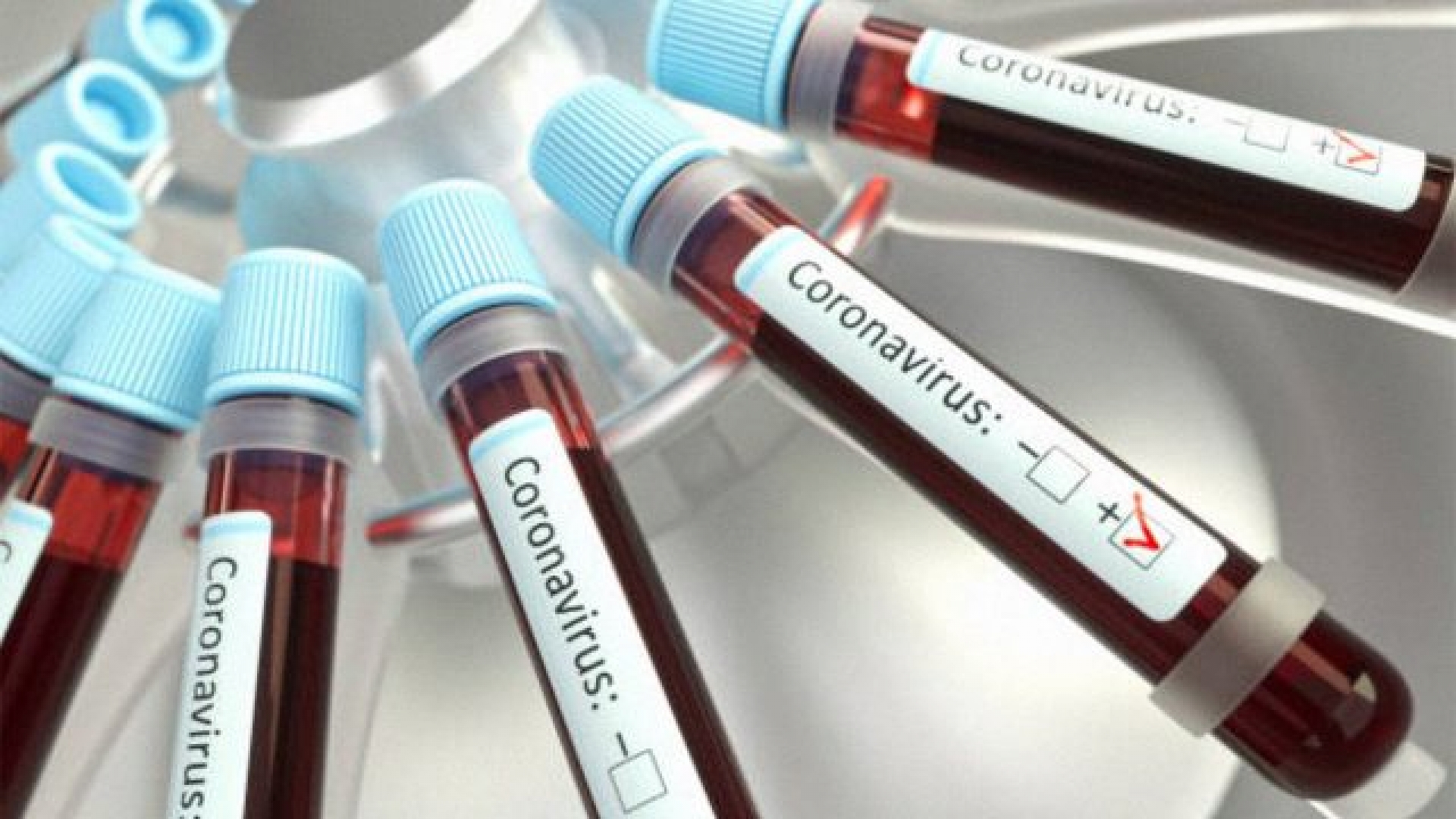 3M y MIT se asocian para crear prueba rápida de Covid-19 y a bajo costo