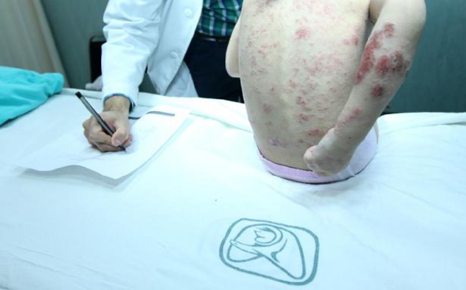 Ofrece IMSS inmunoterapias para atender las alergias