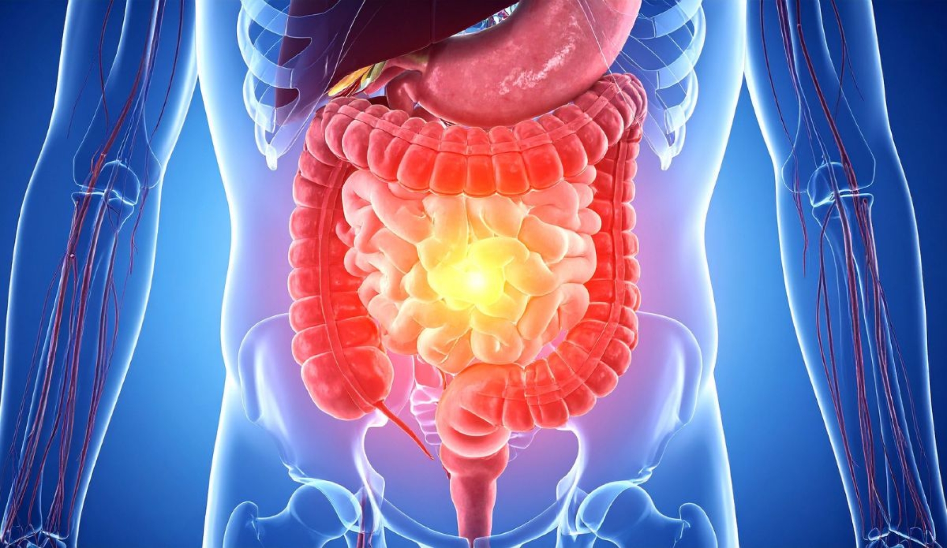Señales en el baño que podrían alertar sobre cáncer de colon