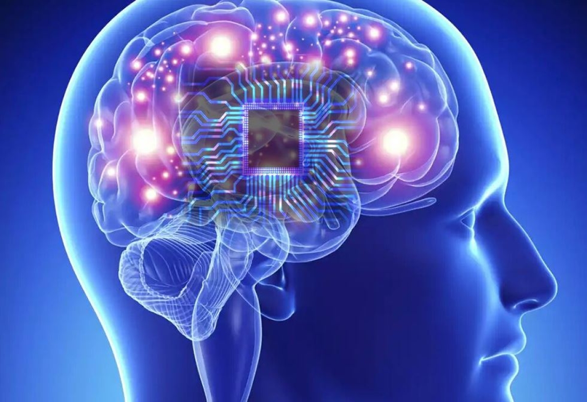 Un implante cerebral logra eliminar la depresión