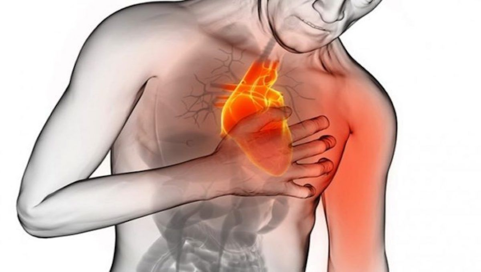 Con Código infarto reducen en 58% mortalidad por infarto al miocardio