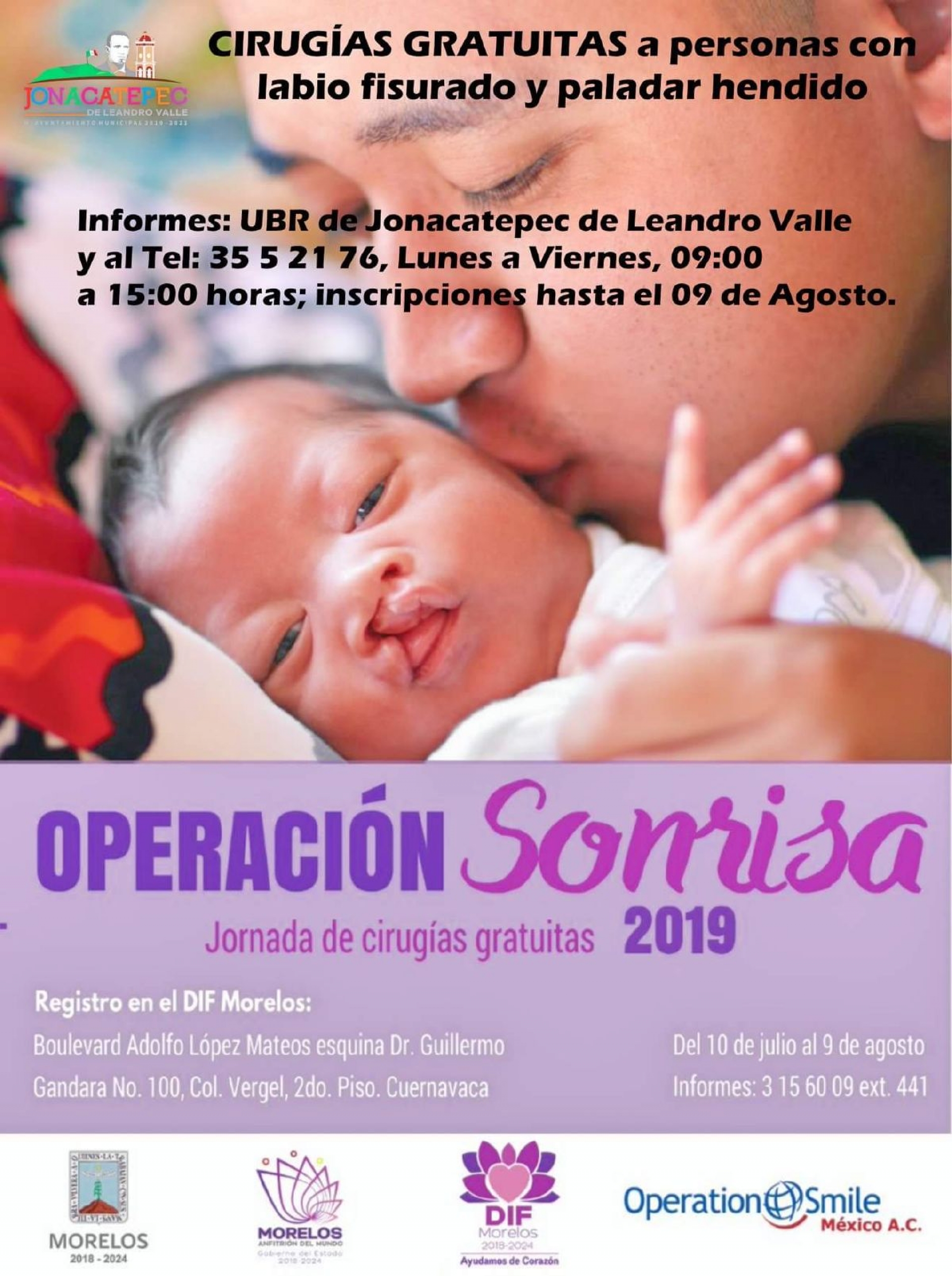 Anuncia campaña de cirugías gratuitas “Operación Sonrisa” en Jonacatepec