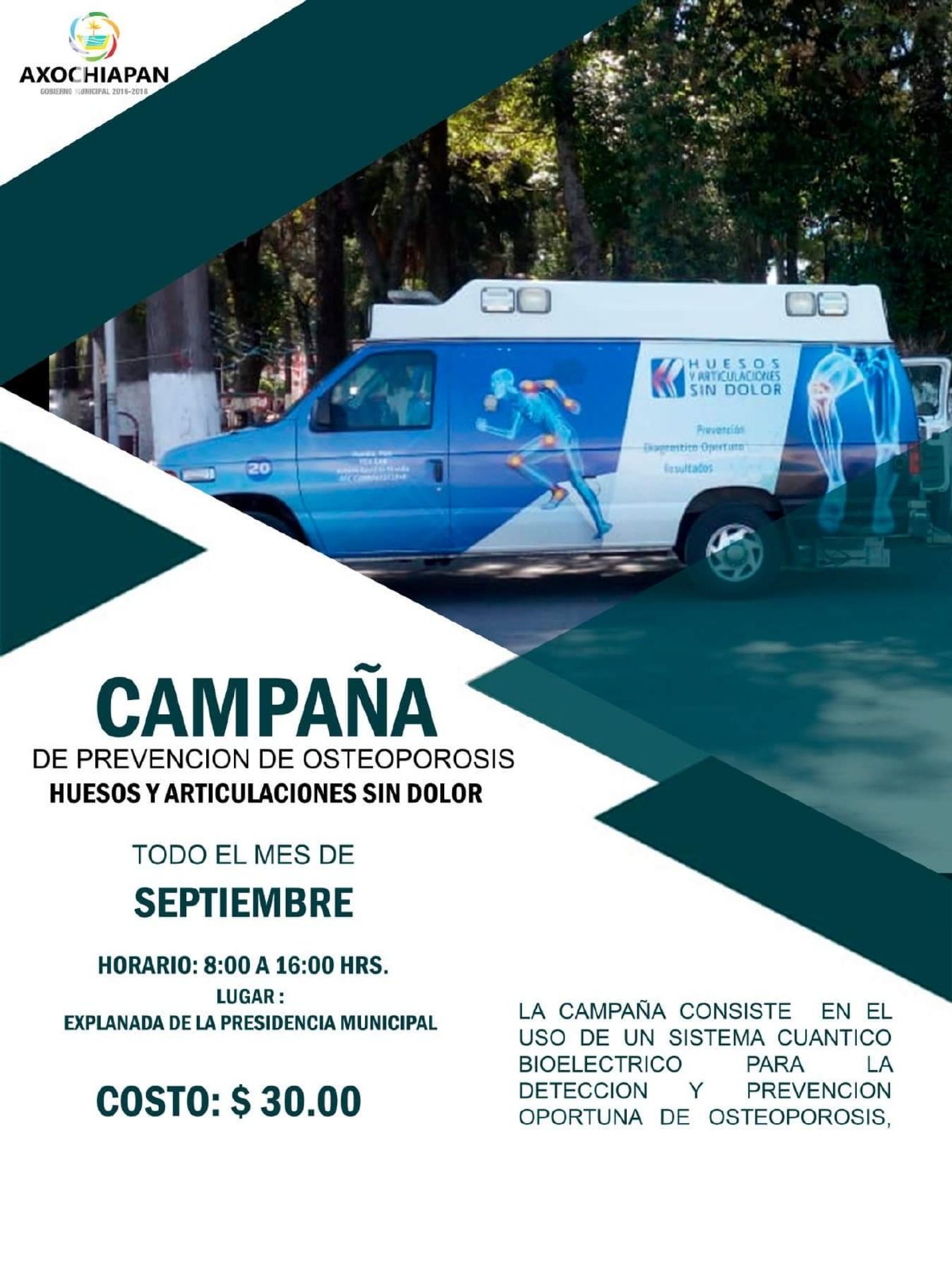 Implementan en Axochiapan campaña de detección de osteoporosis