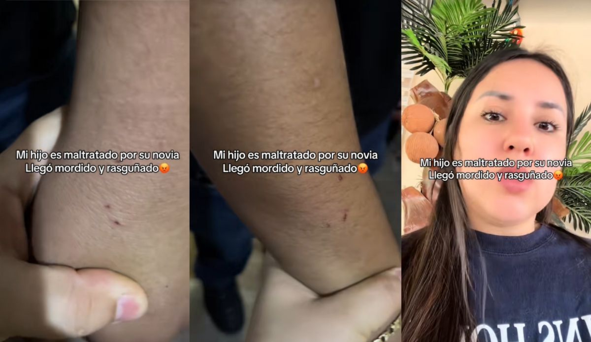 Madre denuncia en TikTok presunto maltrato físico de la novia de su hijo: 'La violencia no tiene género'