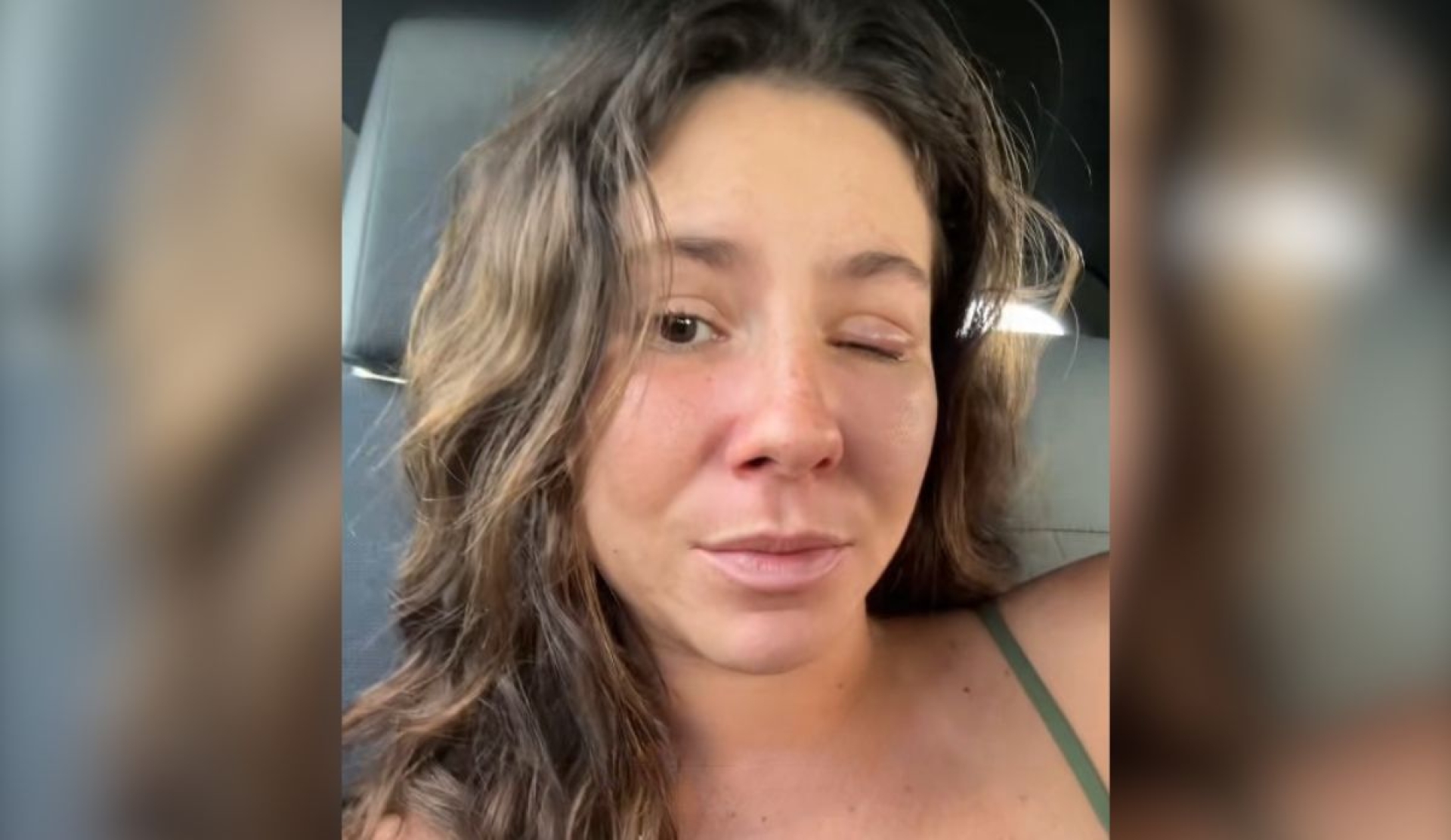 Influencer pierde visión de un ojo tras infección ocular en México