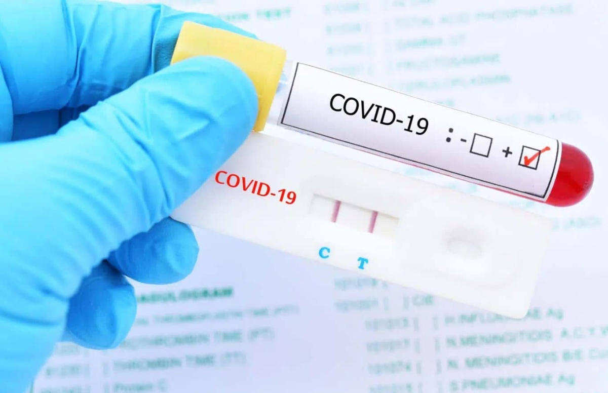 IMSS no requiere prueba positiva COVID para otorgar incapacidad en línea