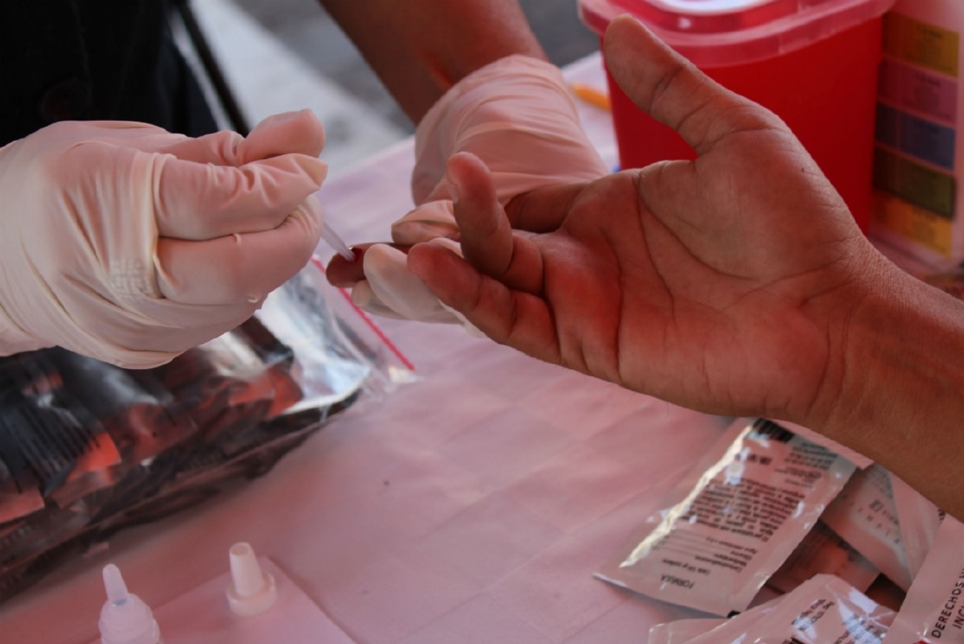 Anuncian campaña de pruebas rápidas de VIH/sida en Cuautla