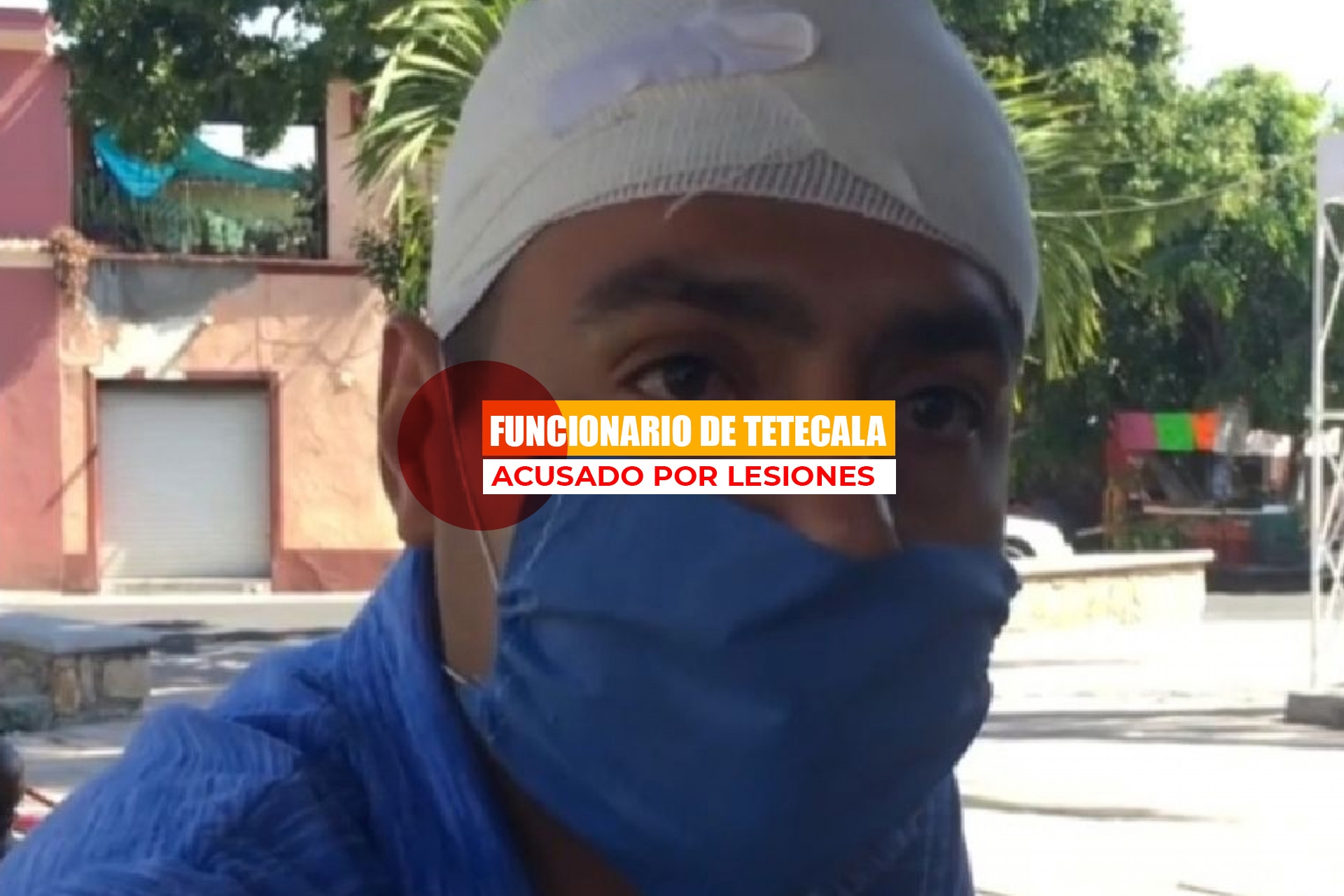 Acusan a funcionario de Tetecala por presuntas lesiones