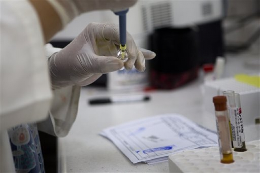 Texas confirma caso de Zika por transmisión sexual