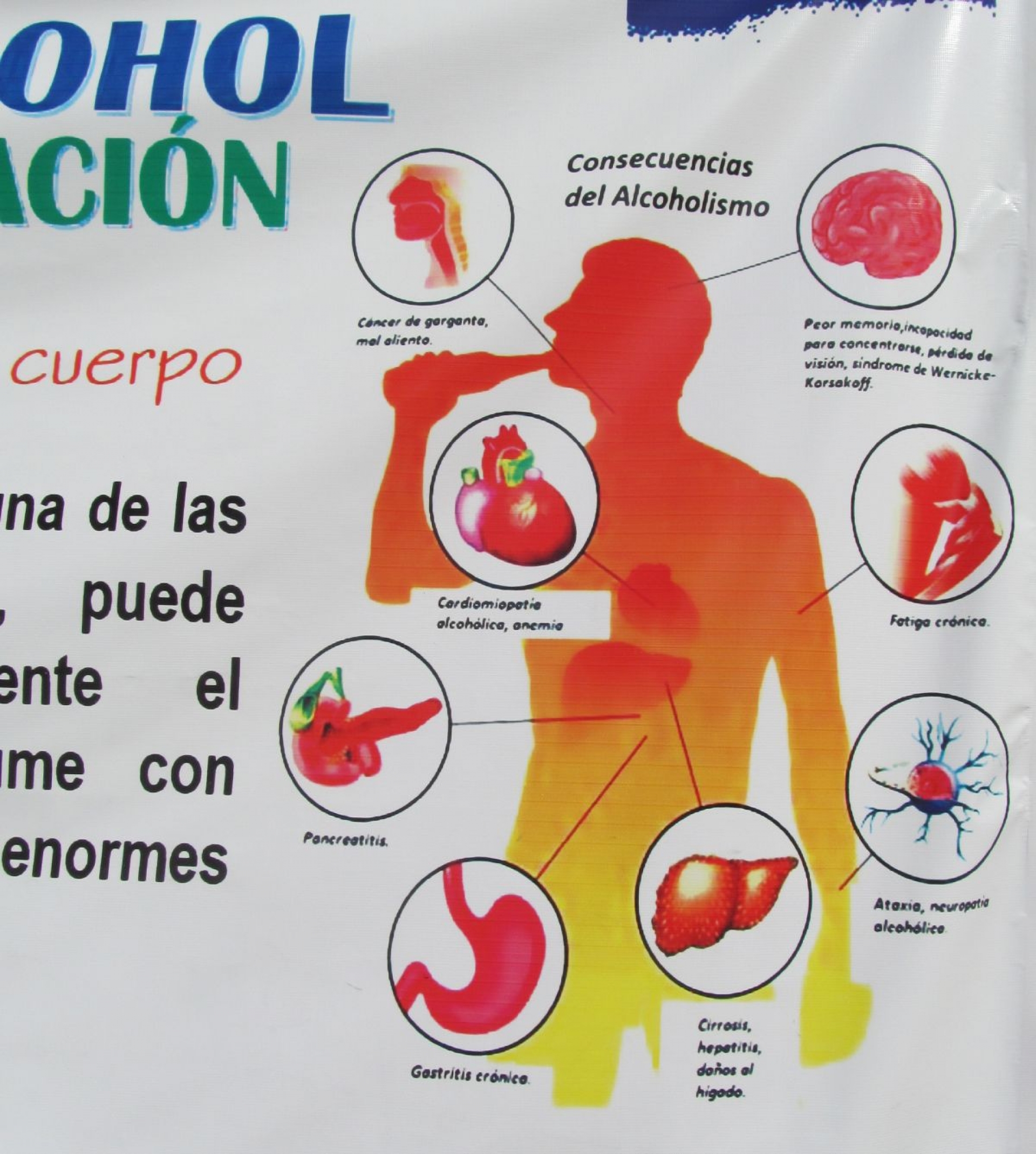 A partir de abril podría aplicarse el alcoholímetro en Zacatepec