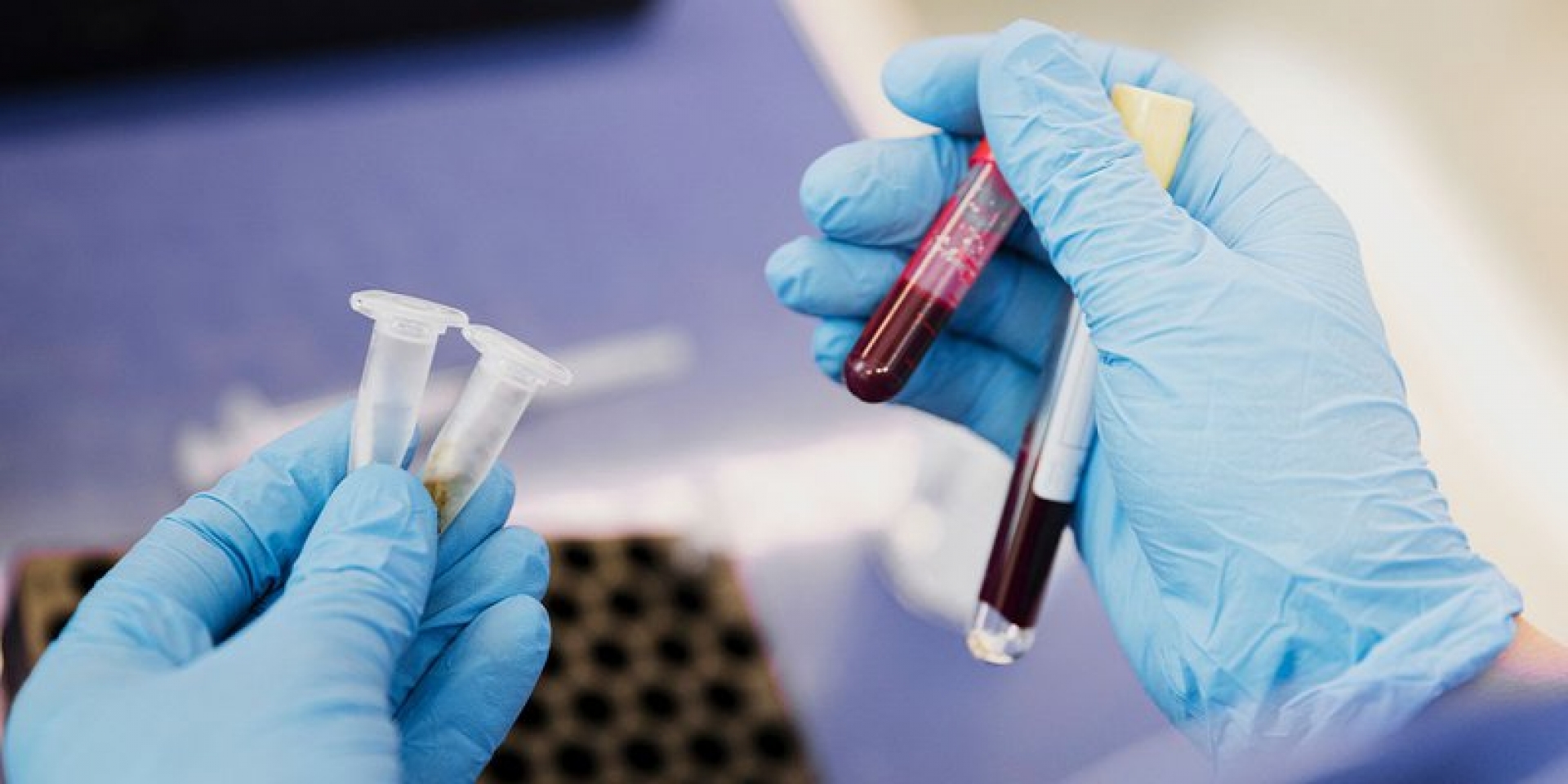 EUA analiza sangre de pacientes recuperados en tratamiento vs COVID-19