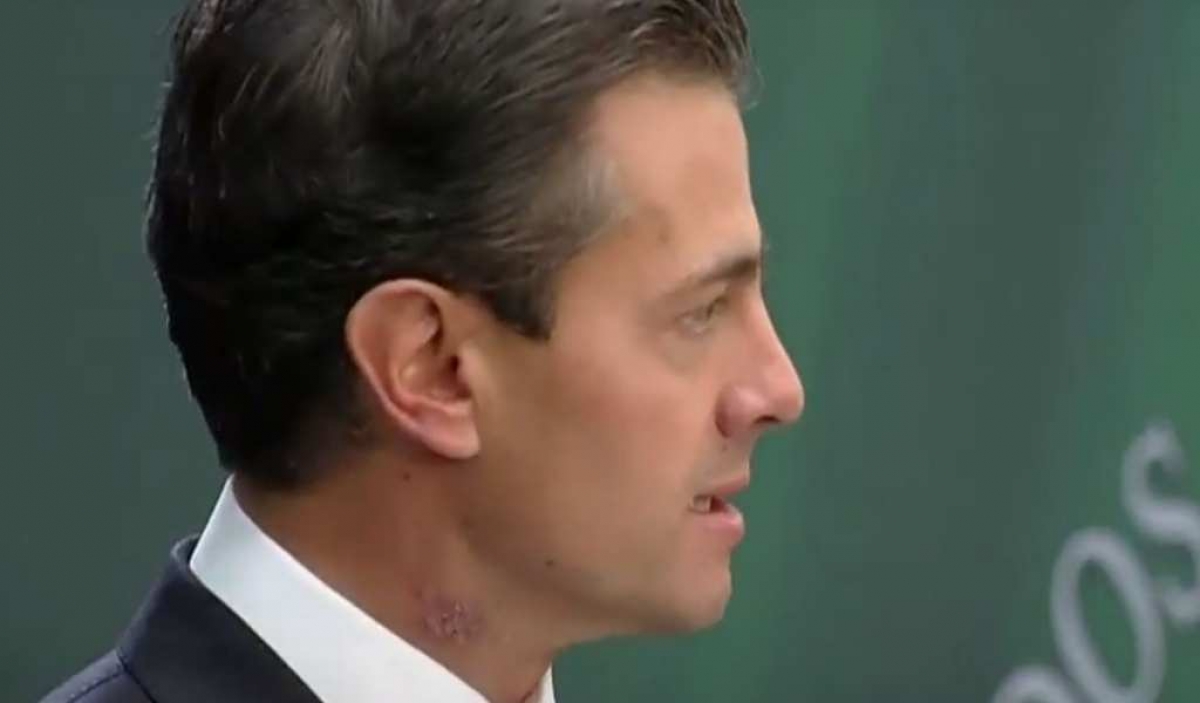 La misteriosa mancha en el cuello de Peña Nieto