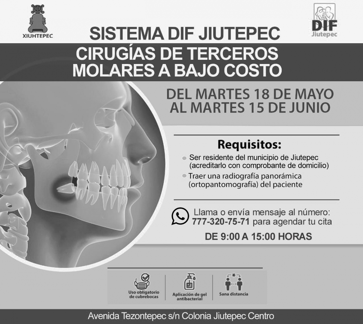 Ofrece DIF Jiutepec extracciones de 'muelas del juicio' a bajo costo