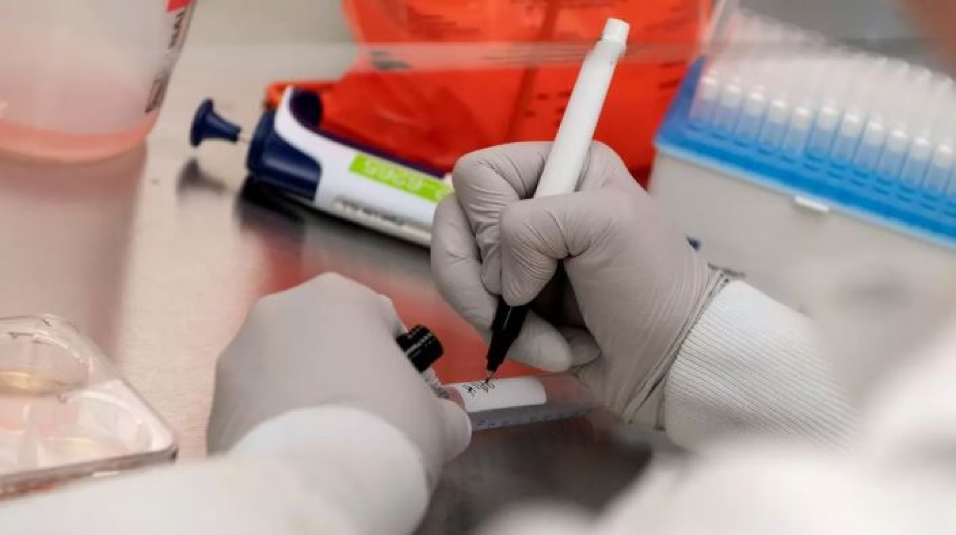 EU da 1,600 mdd a Novavax, uno de los candidatos en carrera por vacuna contra el COVID-19