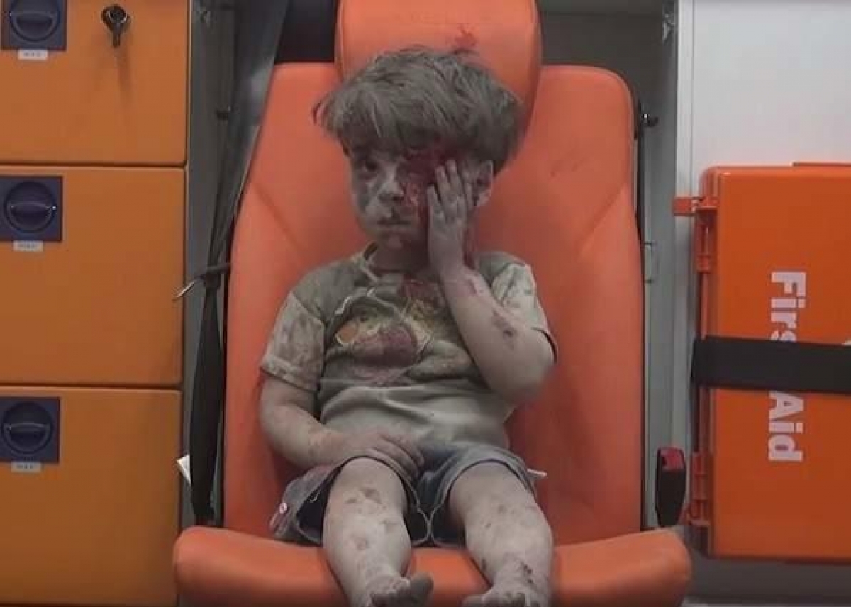 El niño herido en Siria que nos recuerda el horror de la guerra