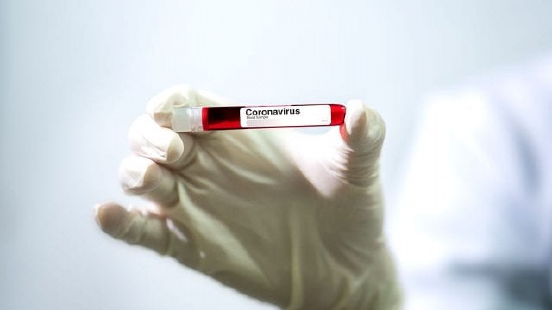 Mexicanos investigan aplicación de plasma para frenar mortalidad de Covid-19