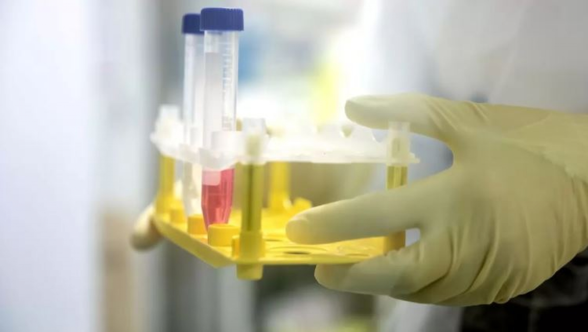 Brasil y Reino Unido llegan a un acuerdo para producir vacuna contra el COVID-19