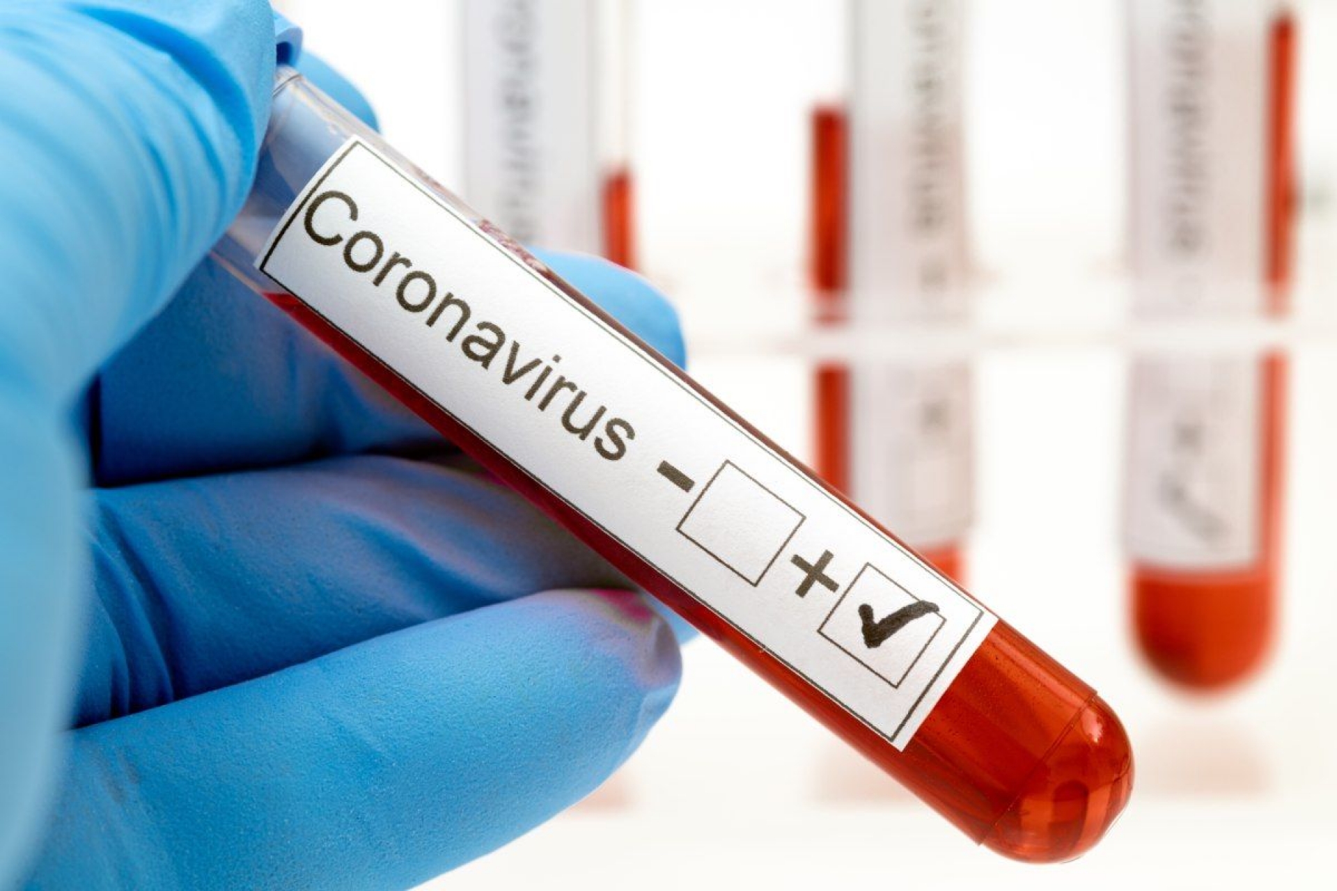 Defiende Cofepris pruebas en sangre para detección de covid-19