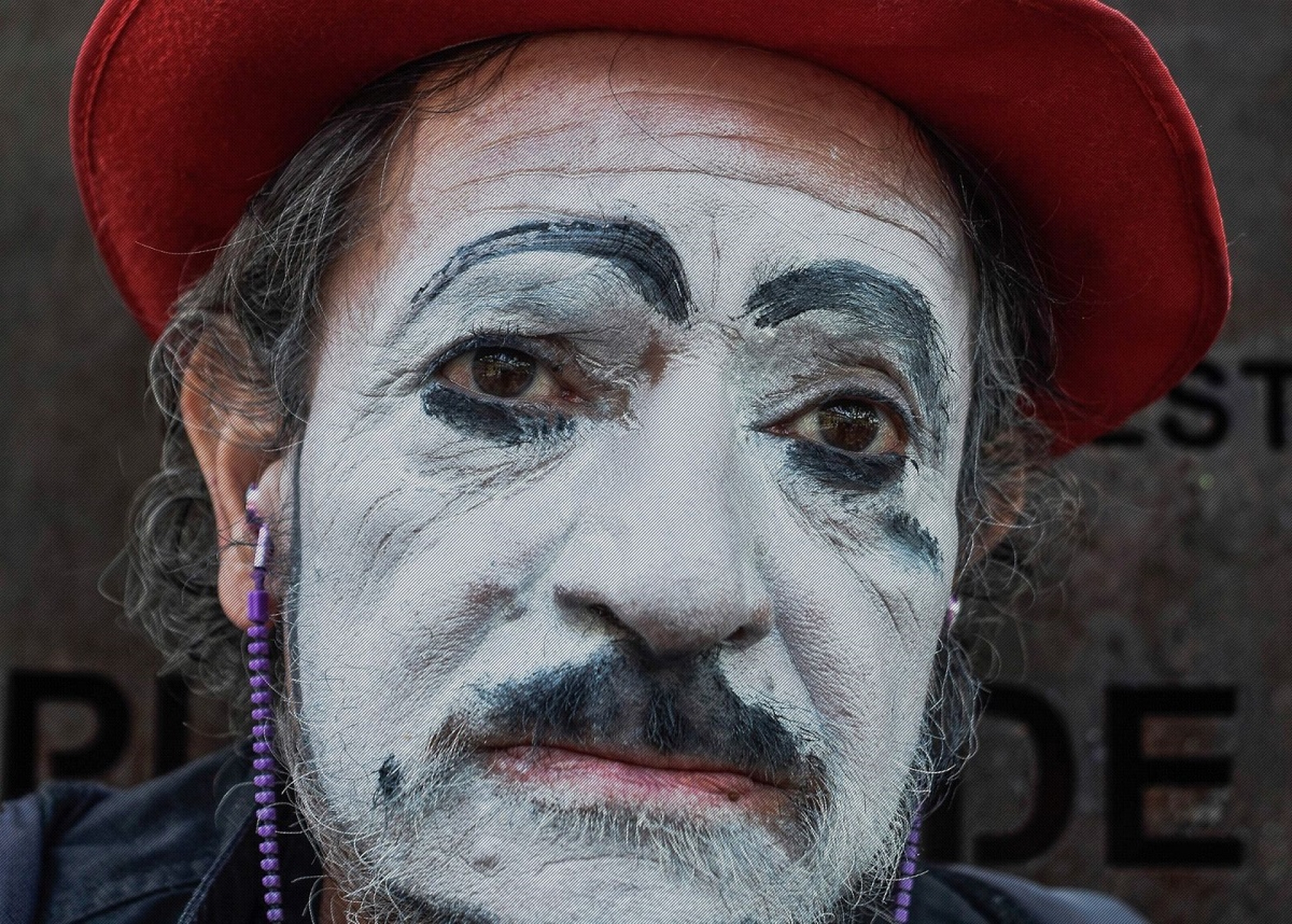 Pactú sufre derrame cerebral y necesita ayuda