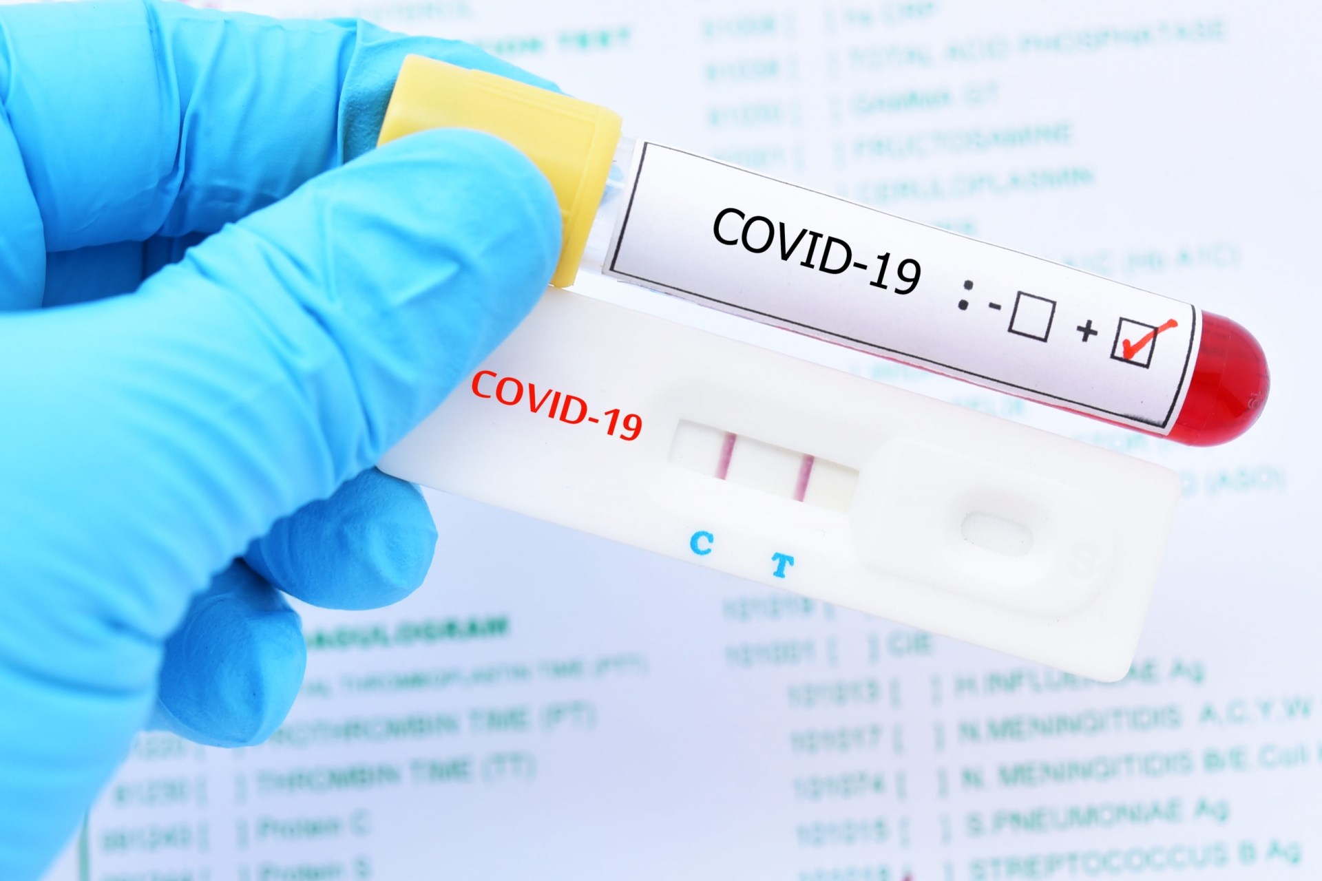 Positivas, el 14 por ciento de las pruebas covid-19 en Jojutla
