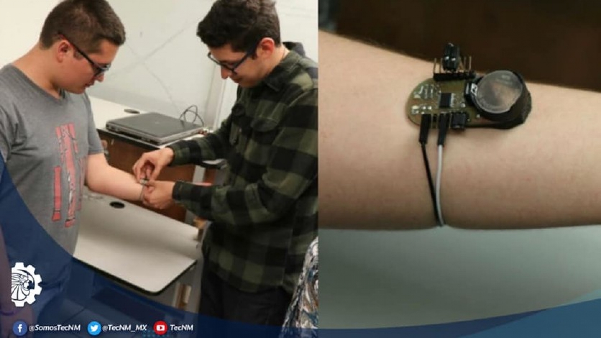 Estudiantes mexicanos desarrollan pulsera para medir glucosa en la sangre