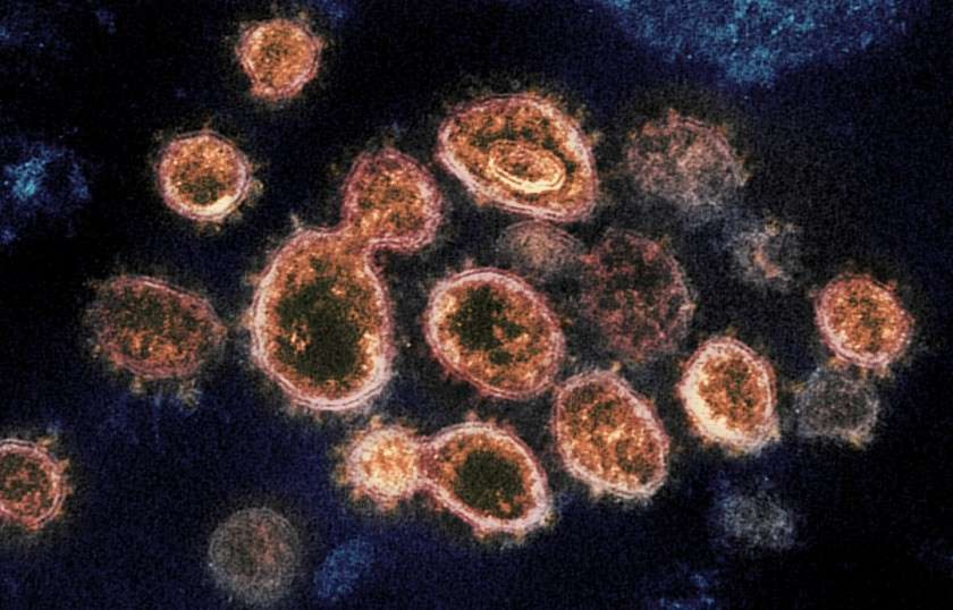 ¿Cuál es la diferencia entre una variante y una cepa de coronavirus?