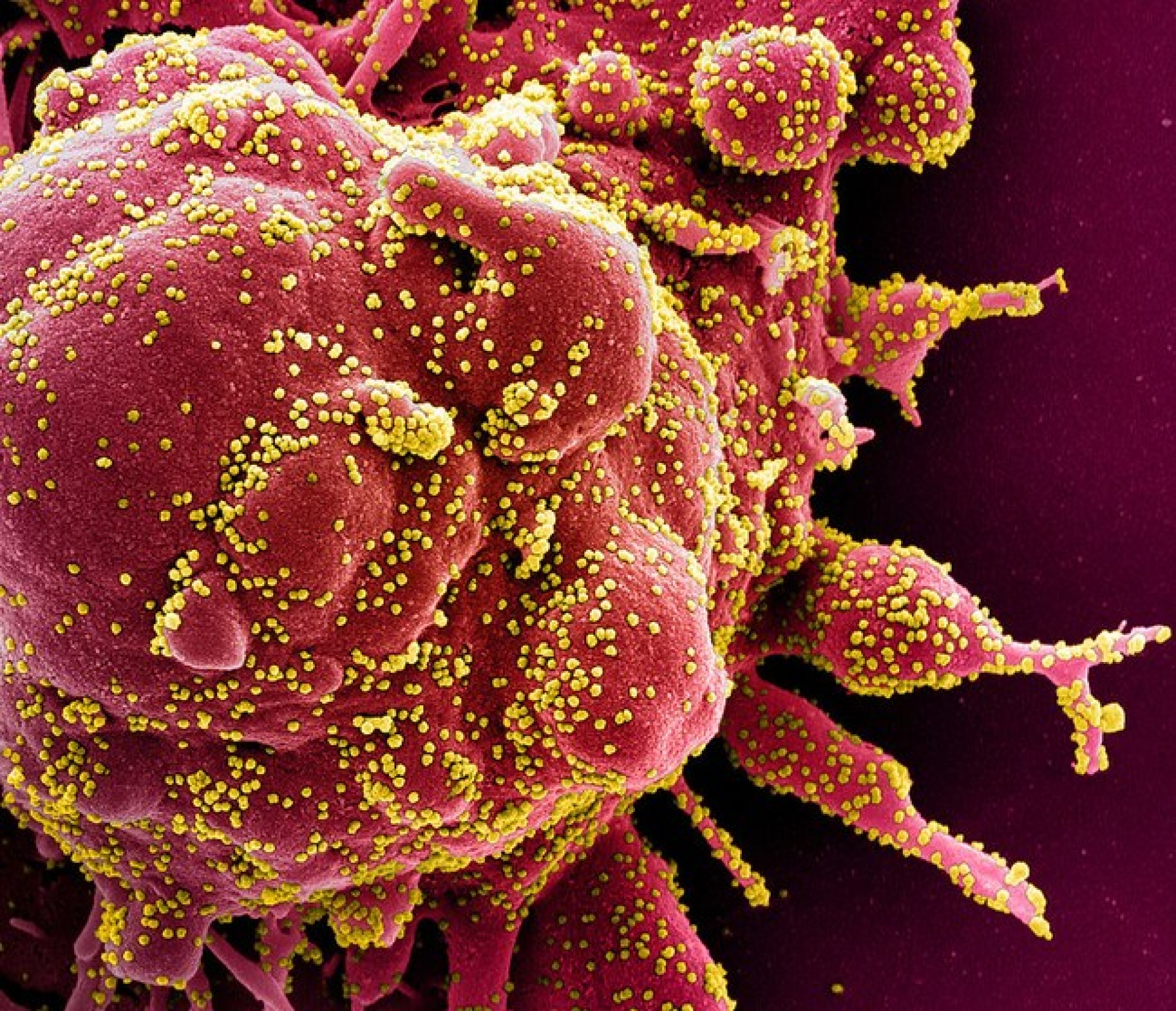 Laboratorio chino, listo para producir posible vacuna contra el coronavirus