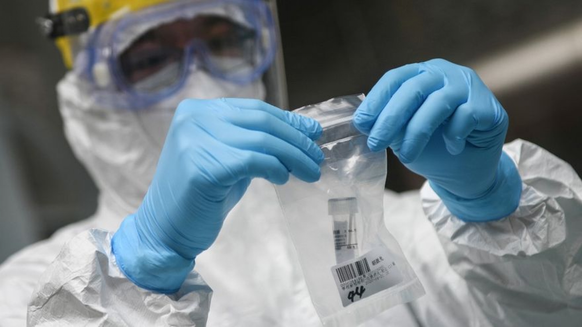 Estudio revela que COVID-19 podría transmitirse a través del semen