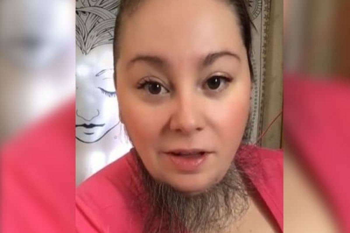 Mujer con barba abre Onlyfans y enamora a los hombres