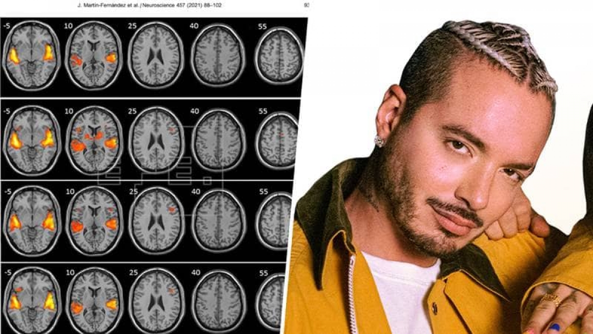 Estudio demuestra que escuchar "reguetón" ayuda a activar tu cerebro