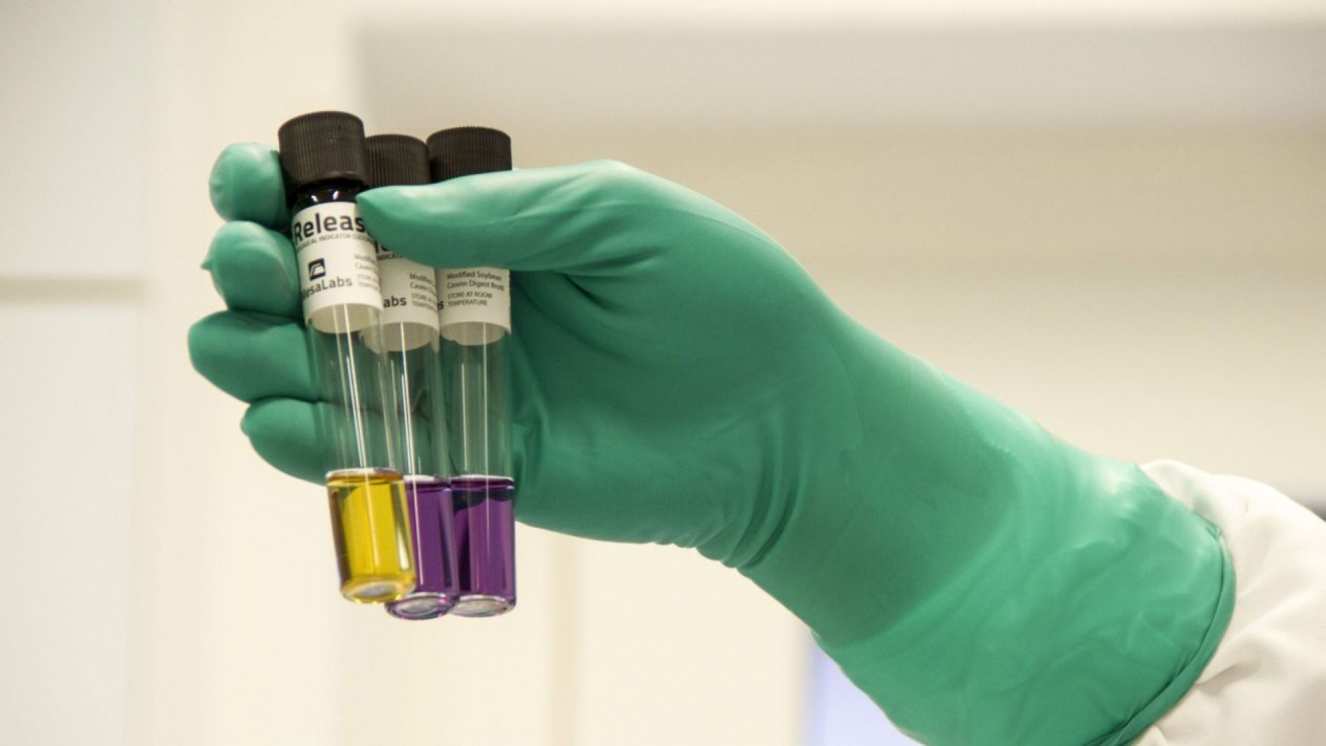 Congo registra nuevo brote de ébola; ya hay al menos 4 muertos
