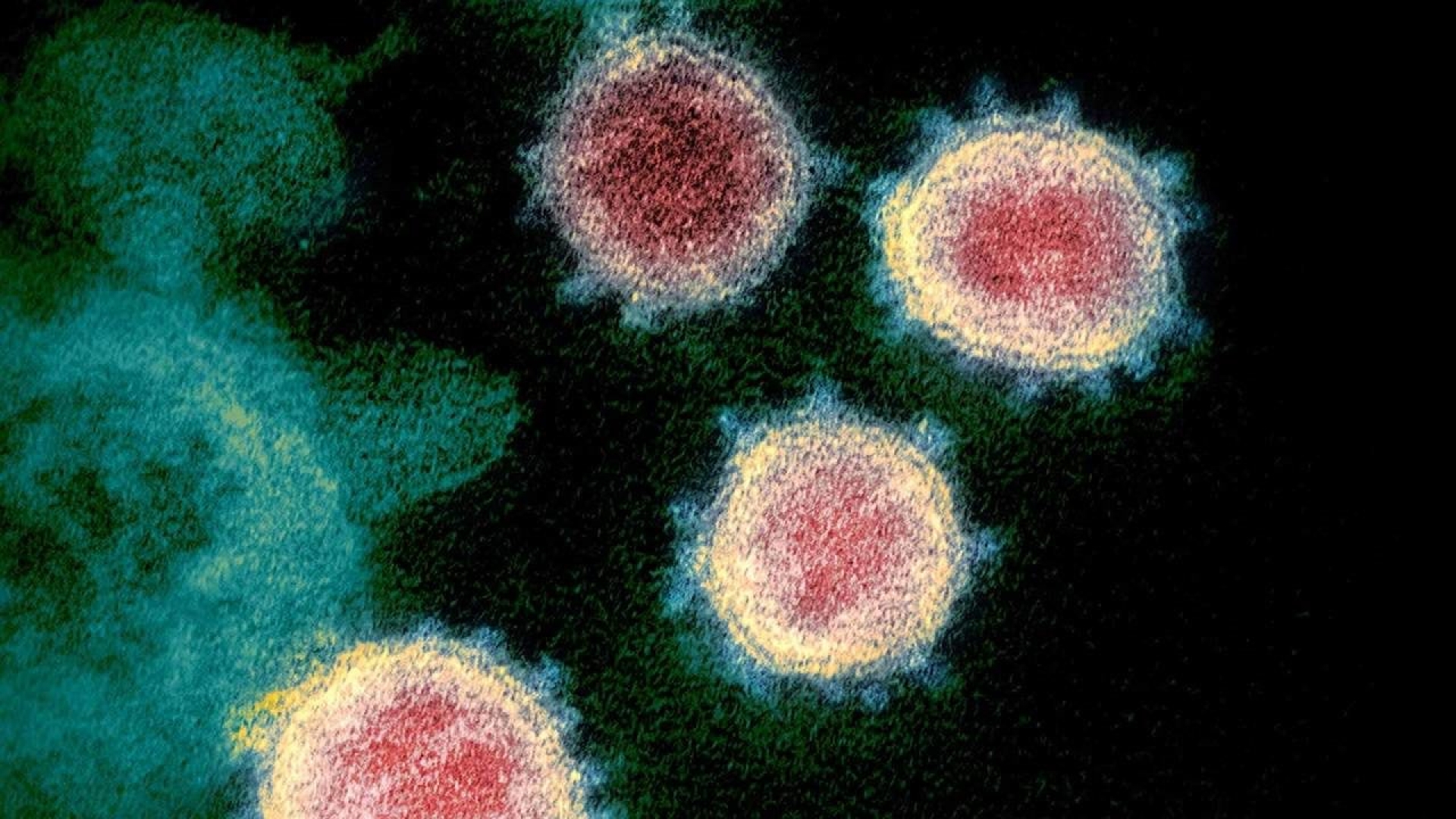 Aquí está la primera imagen real del virus SARS-CoV-2