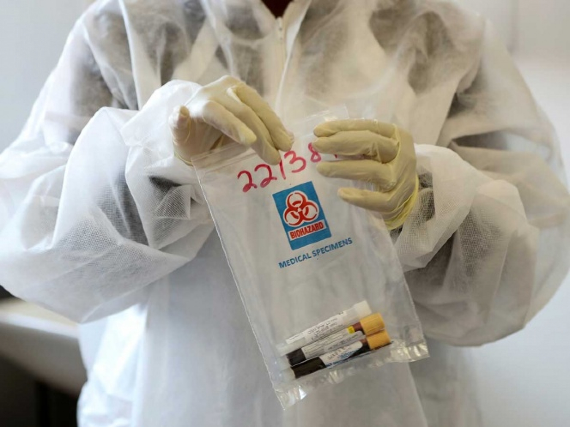 AstraZeneca registra un segundo voluntario enfermo