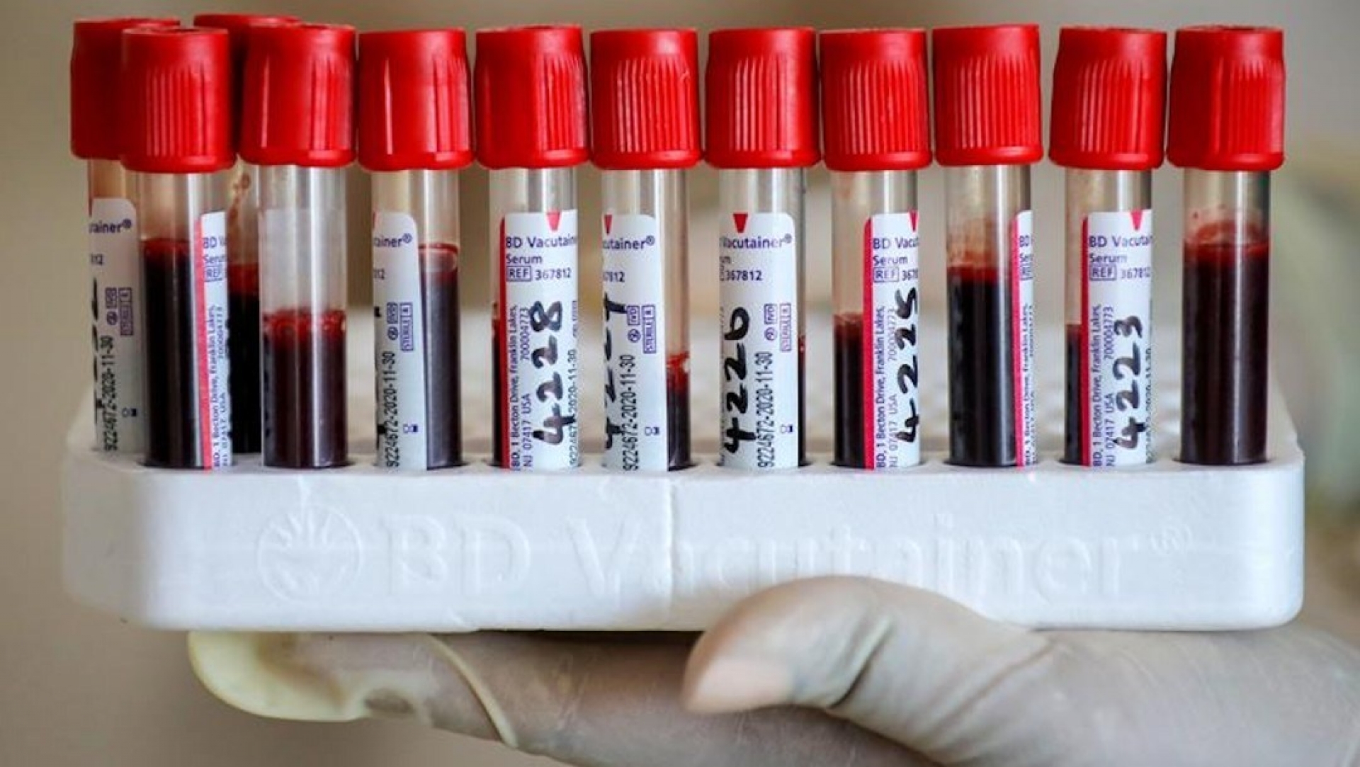 Hong Kong detecta posible brote en laboratorio que investiga el COVID-19