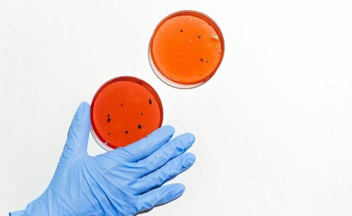 Investigadores proponen alternativa para combatir bacterias resistentes a antibióticos