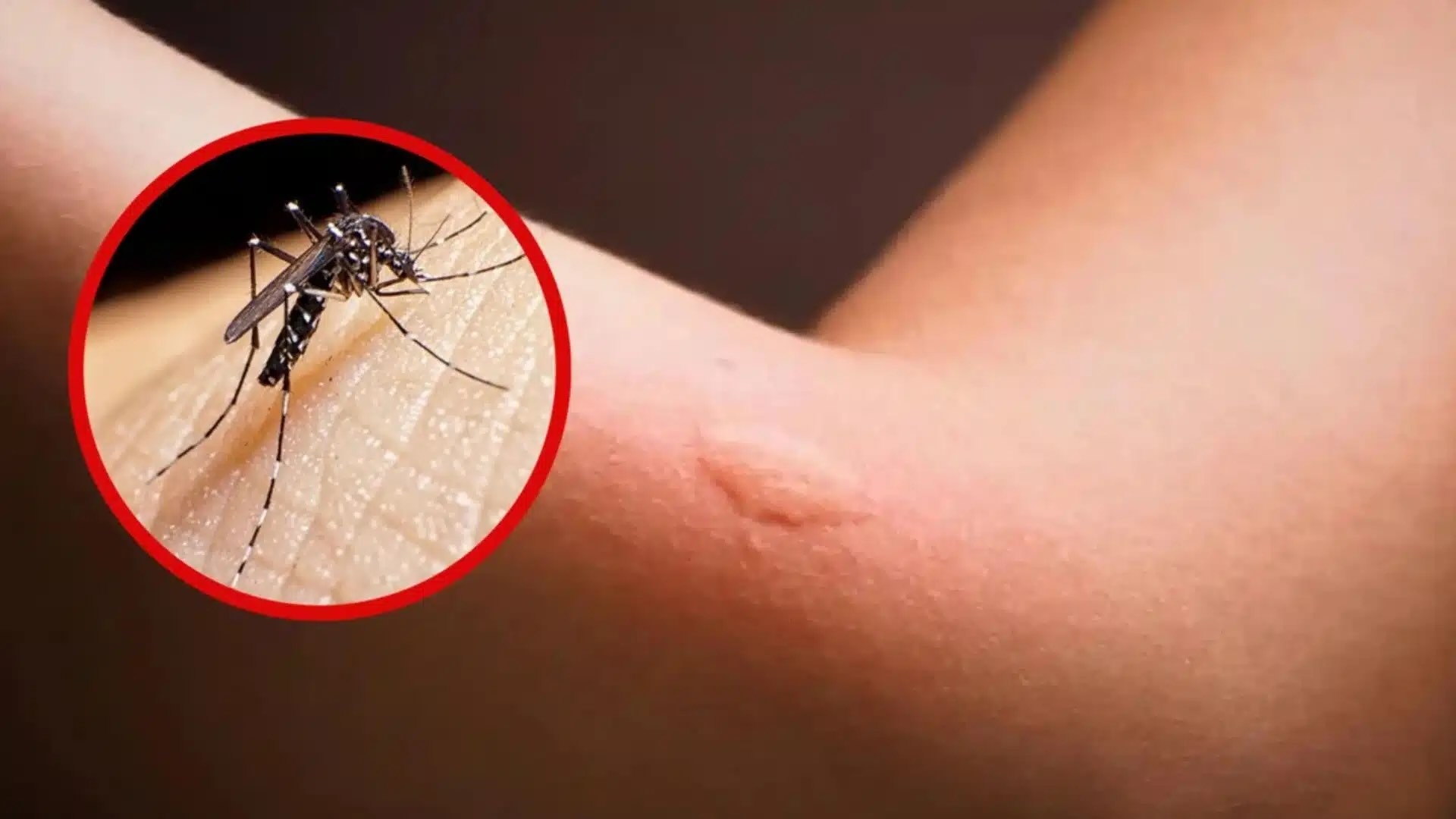 Niegan 'cifra negra' de casos de dengue