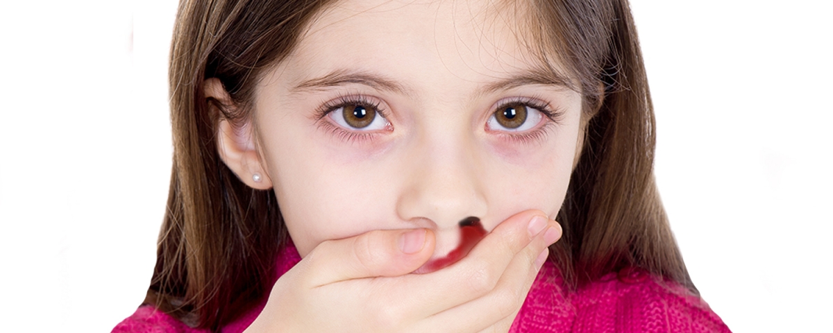 Qué hacer si tu hijo tiene sangrado nasal