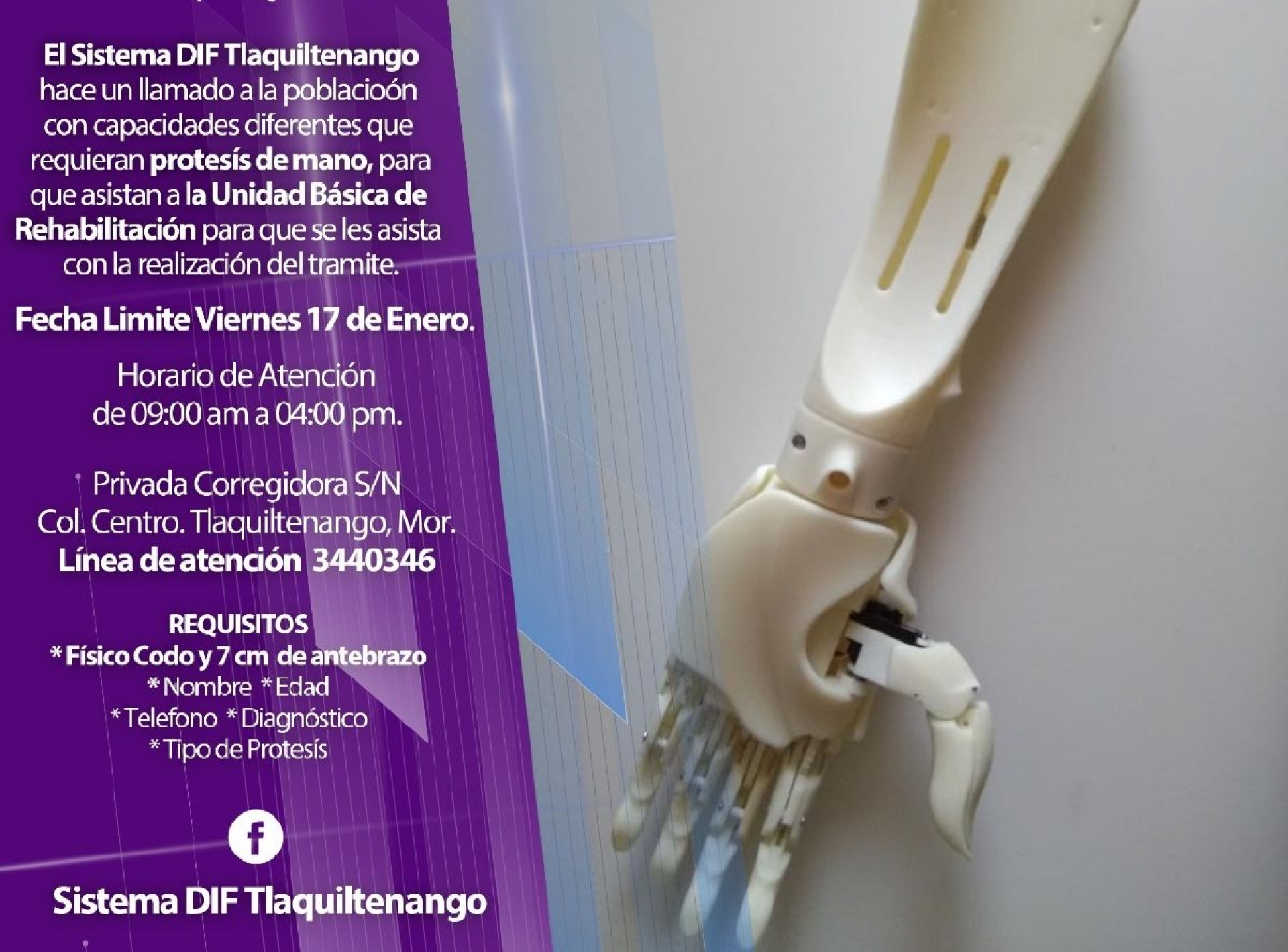 Realizan campaña de donación de prótesis de mano en Tlaquiltenango