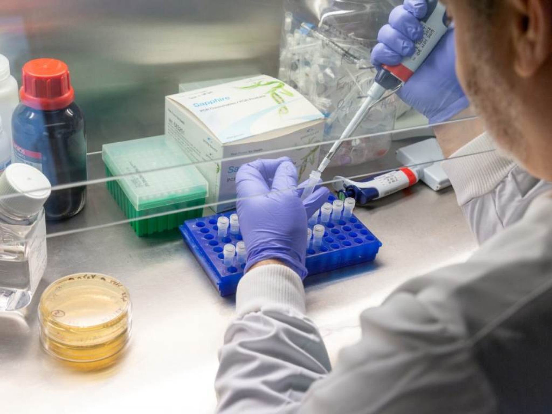 Confirman primer caso de gripe porcina en humano en el Reino Unido